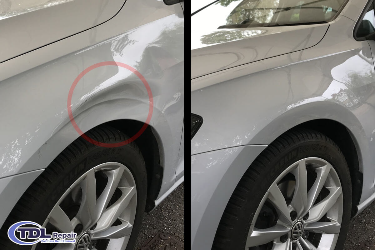 Paintless Dent Repair - Dent Removal Service - A1 Auto Body Shop
